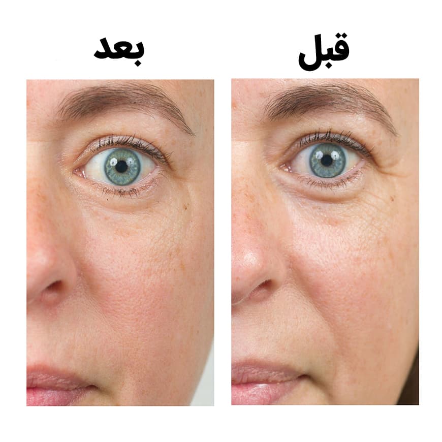 اینکی لیست مرطوب کننده بایواکتیو سرامید اینکی لیست - تصویر 3
