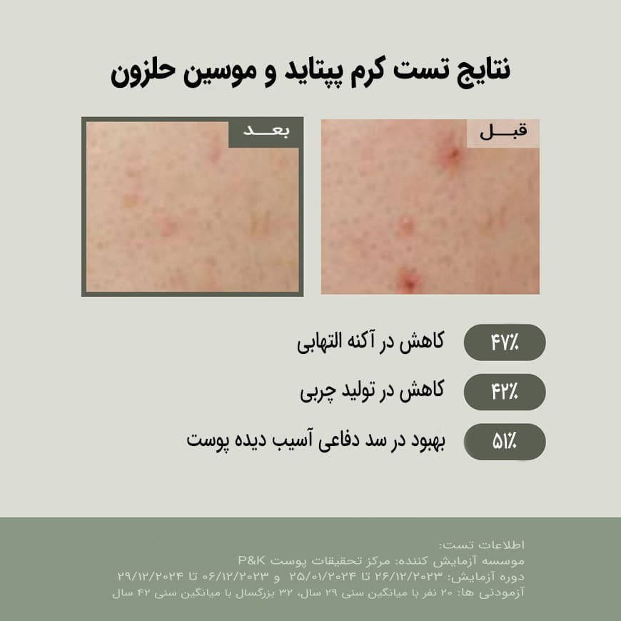 جومیسو کرم آبرسان موسین حلزون و پپتاید جومیسو - تصویر 3