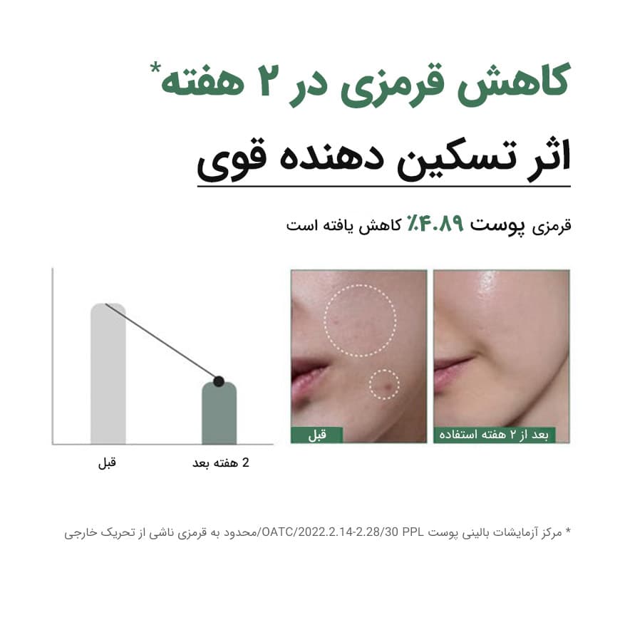 آنوا سرم آبرسان و تسکین دهنده هارتلیف آنوا - تصویر 4