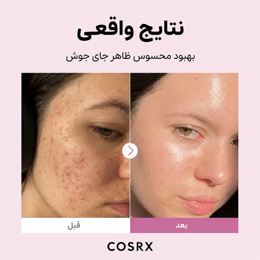 کوزارکس سرم نیاسینامید ۱۵ کوزارکس - تصویر 3