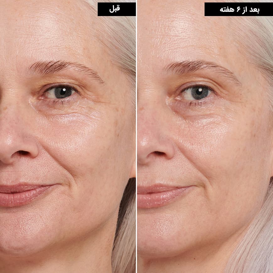 اینکی لیست کرم دور چشم رتینول اینکی لیست - تصویر 3