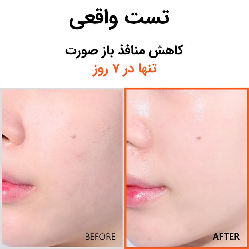 ایزنتری سرم هایپر نیاسینامید ایزنتری - تصویر 2