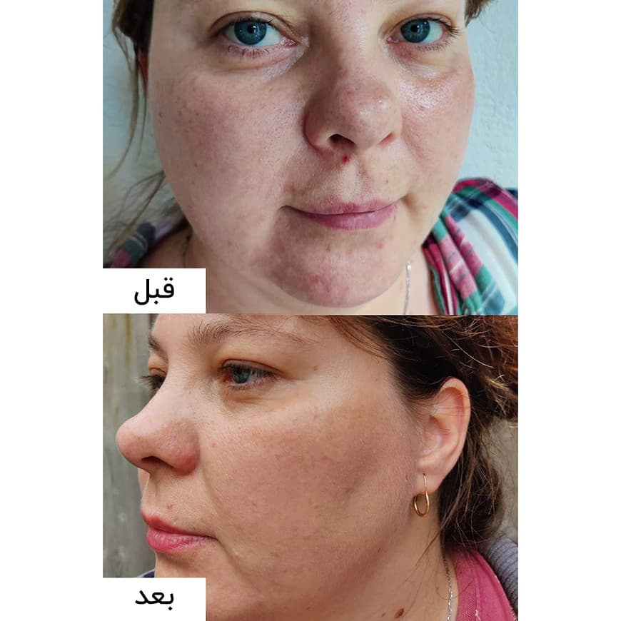 بیوتی آف جوسان ست روشن کننده برنج بیوتی آف جوسان - تصویر 3