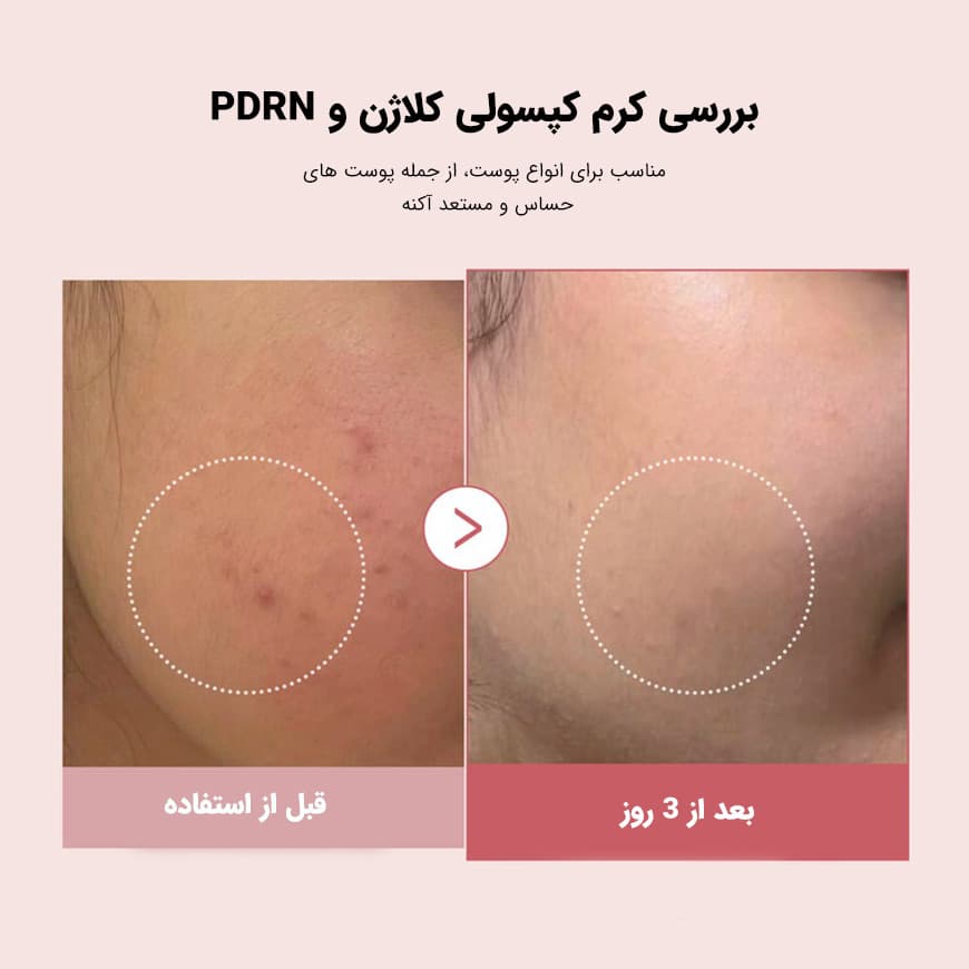 مدیکیوب کرم کپسولی کلاژن و PDRN مدی کیوب - تصویر 5