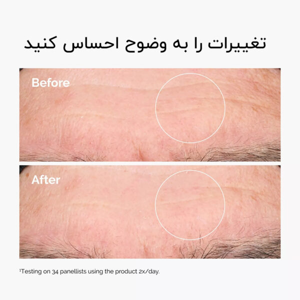 سرم آبرسان هیالورونیک اسید حاوی سراماید اوردینری