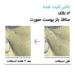 تونر لایه بردار و کنترل کننده منافذ آنوا - تصویر 3