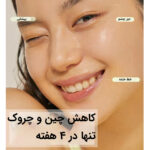 سرم رتینول 0.5% کوزارکس - تصویر 3