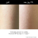 لوسیون بدن لایه بردار و آبرسان PHA اینکی لیست - تصویر 3