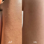 لوسیون بدن لایه بردار و آبرسان PHA اینکی لیست - تصویر 4